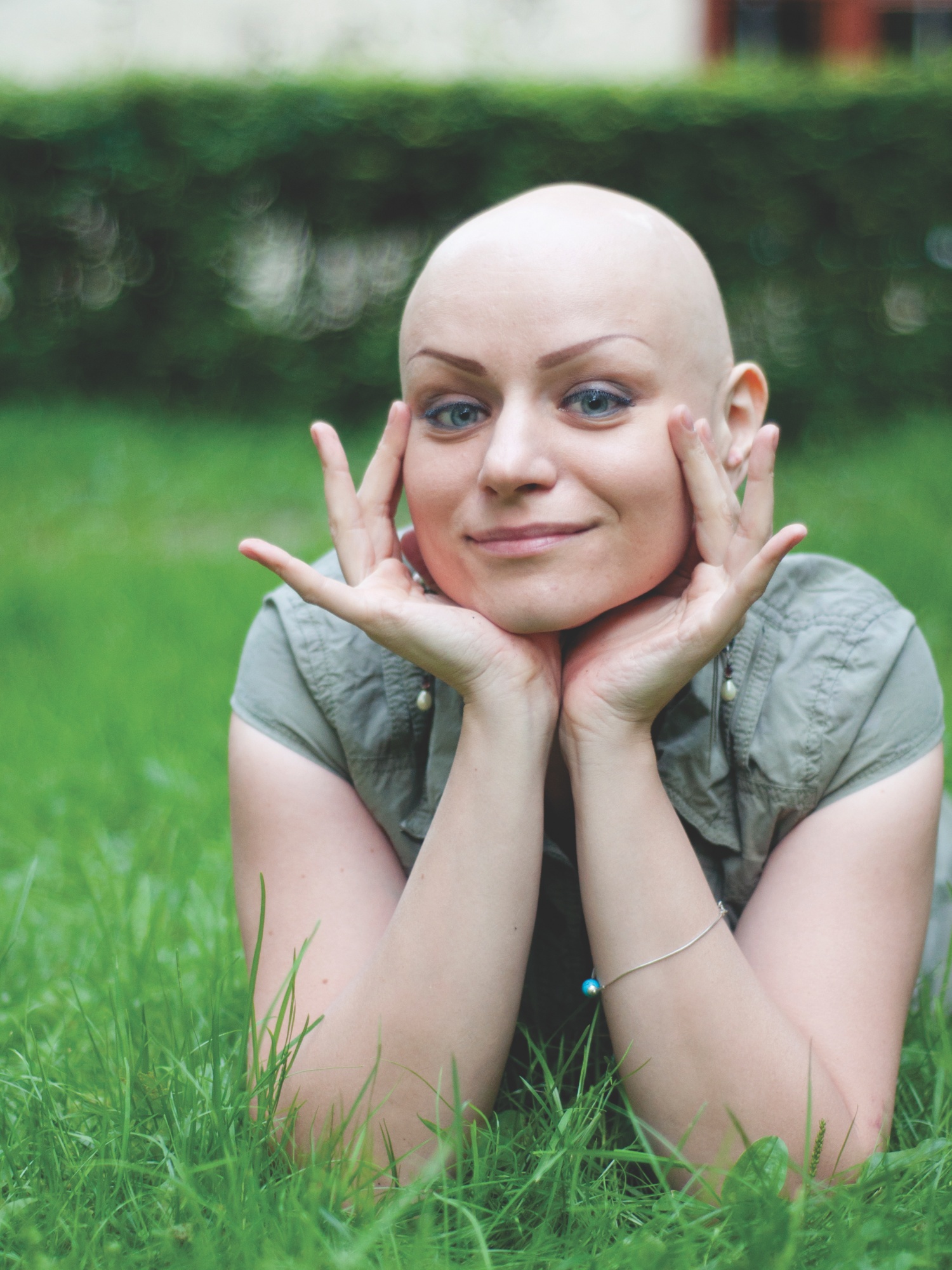 Alopecija serga tiek vyrai, tiek moterys, tačiau psichologiškai ši liga yra kur kas sudėtingesnė moterims